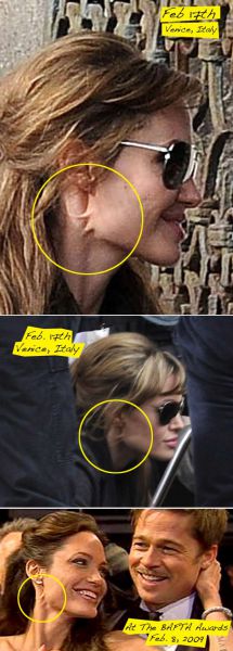 Проблемы на лице Анджелины Джоли — не фотошоп
